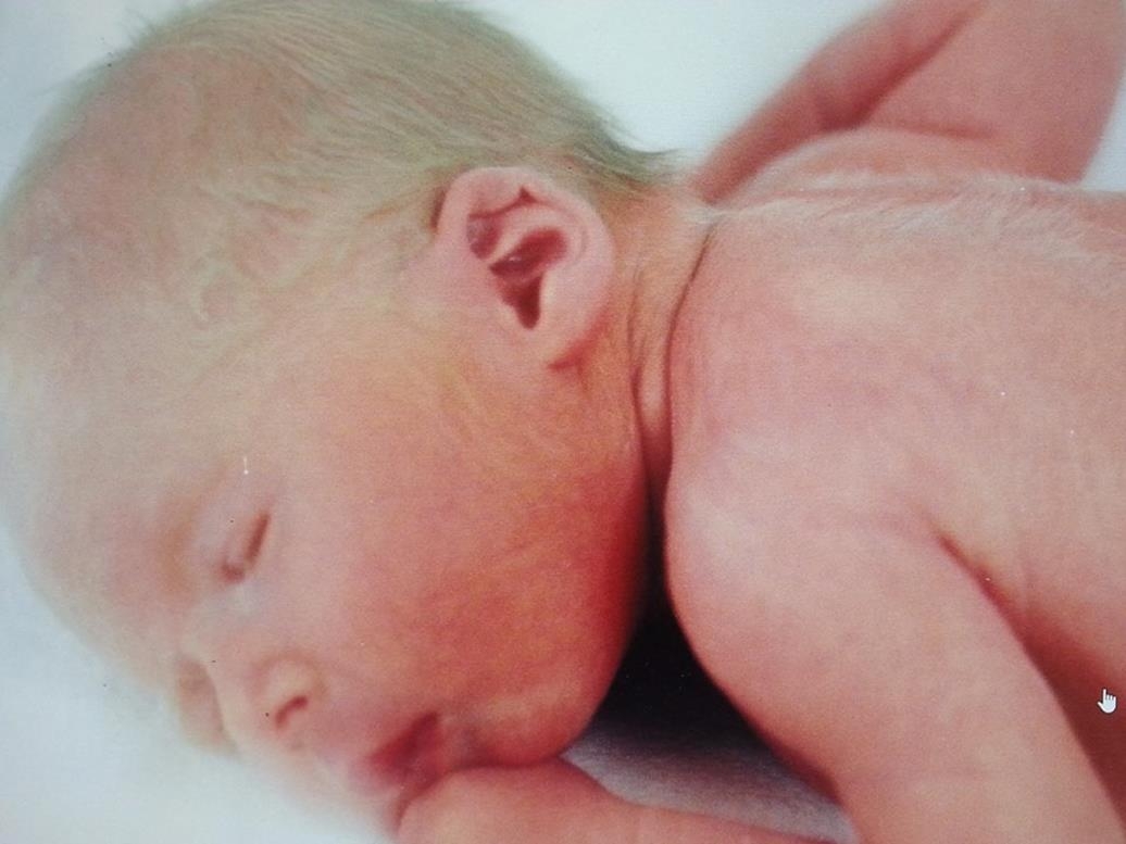 March For Babies Support Fundraising For Bob And Zack Stein